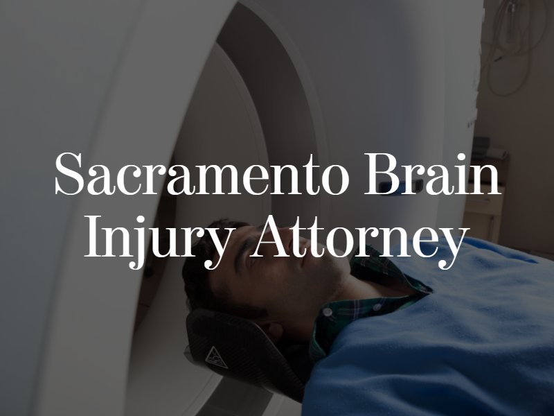 Sacramento Brain Injury Attorney