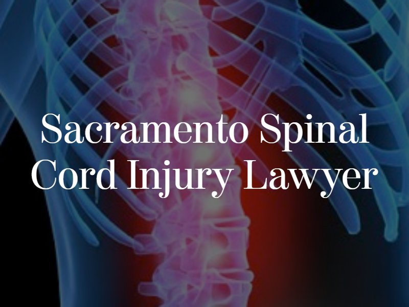 Sacramento spinal cord injury lawyer